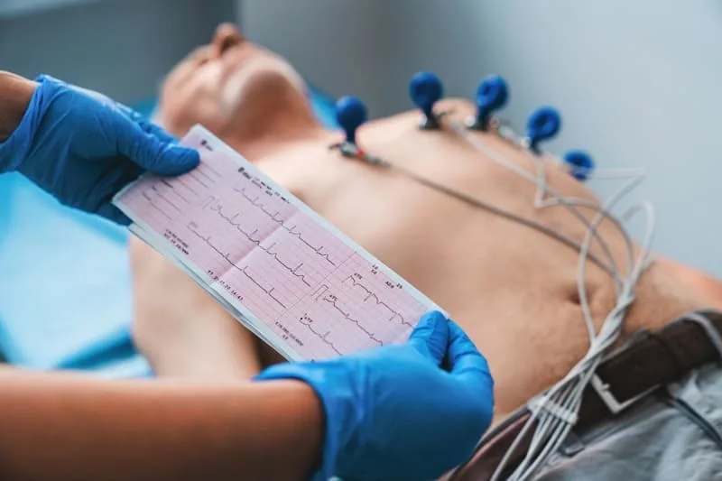 Ecocardiograma