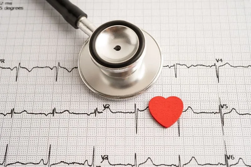Electrocardiograma